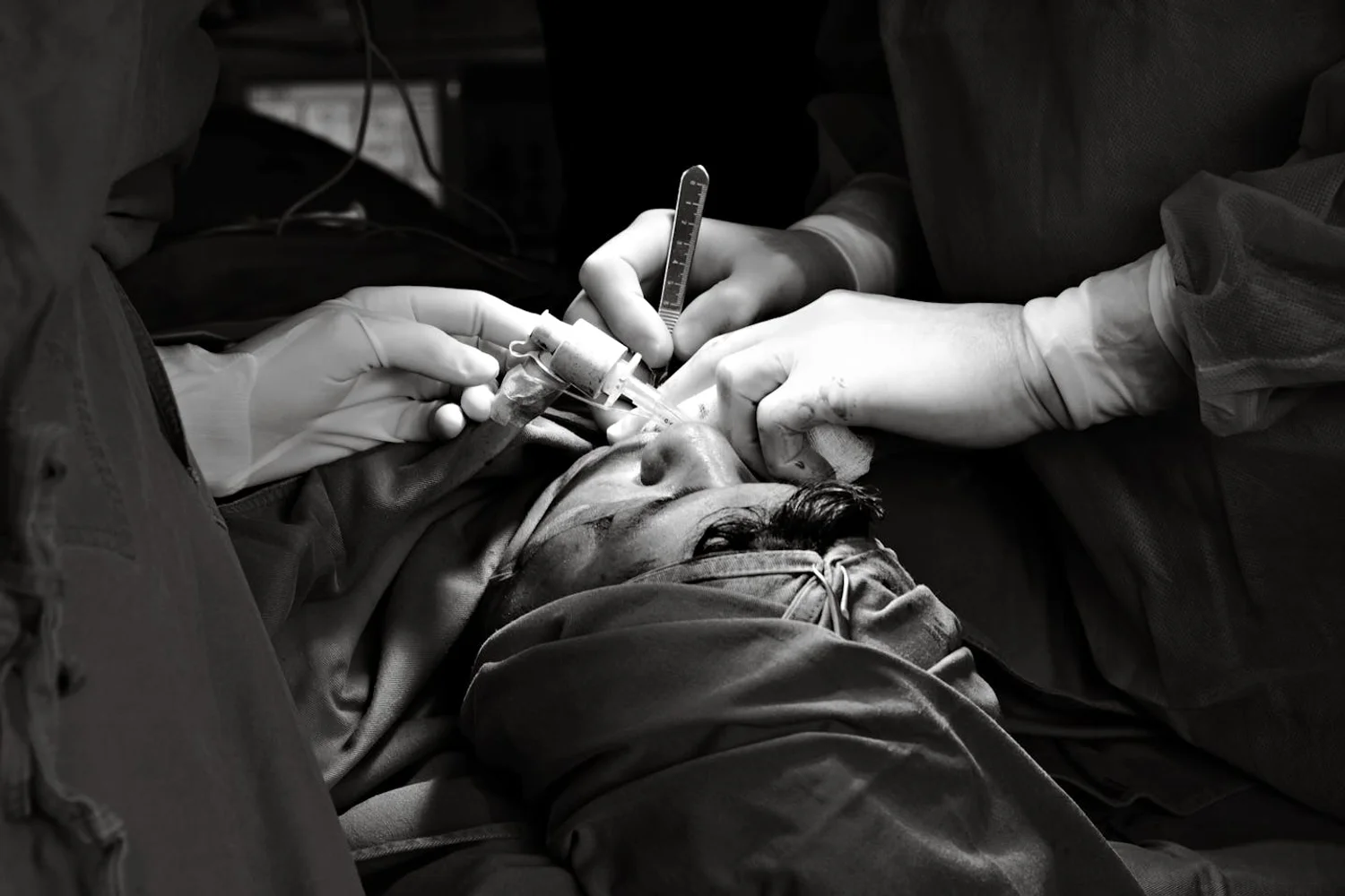 Fono Aprende Colombia · otolaryngologist surgery adult patient