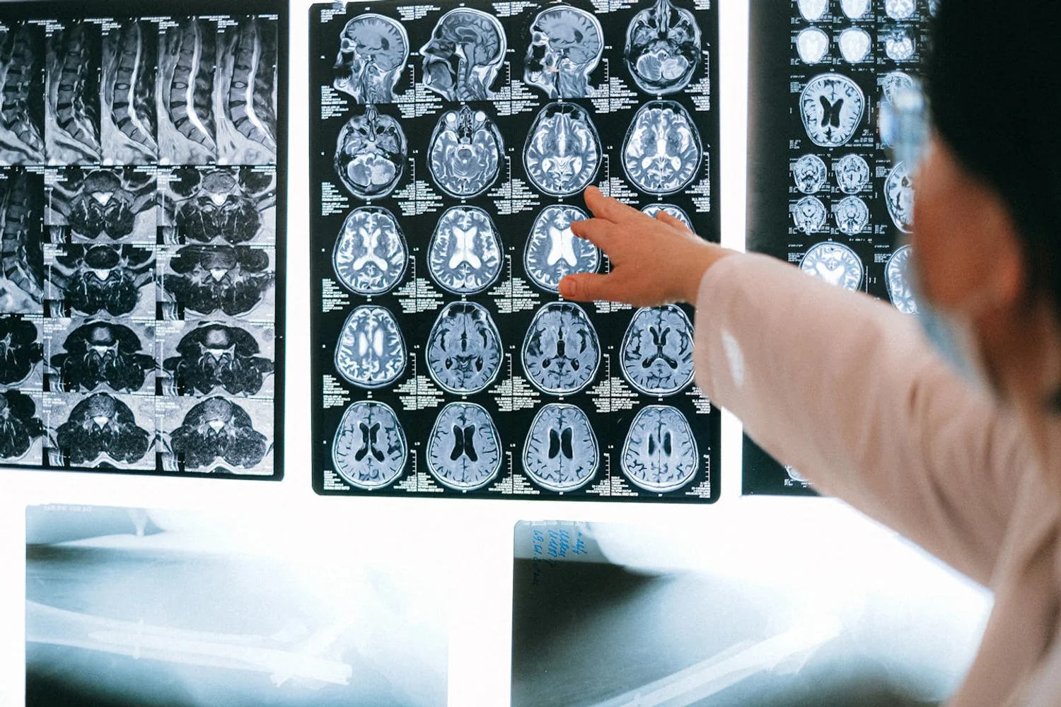 Fono Aprende Colombia · neurological patient hospital rehabilitation