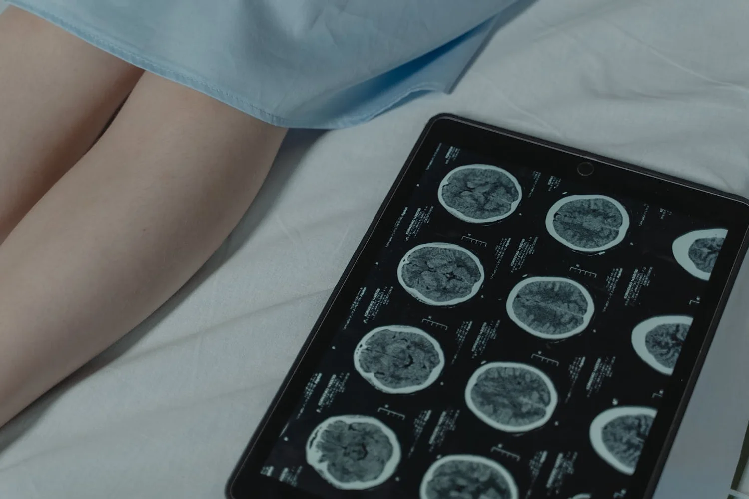 Fono Aprende Colombia · elderly patient hospital neurological
